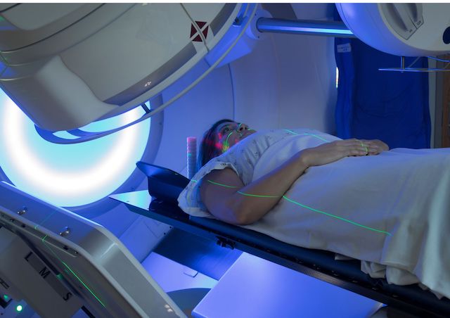 breast radiotherapy